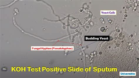 Hyphae Of Fungi Microscope