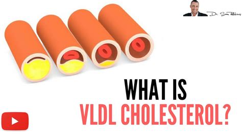 Low Vldl Cholesterol Means