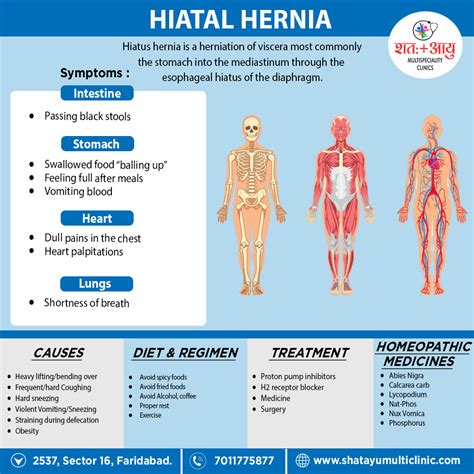 Hiatal hernia – SHATAYU MULTI-SPECIALITY CLINIC