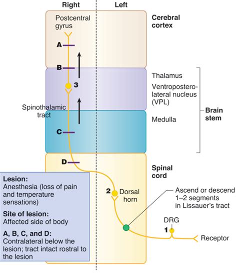 lateral spinothalamic tract | Brain anatomy, Spinothalamic tract ...