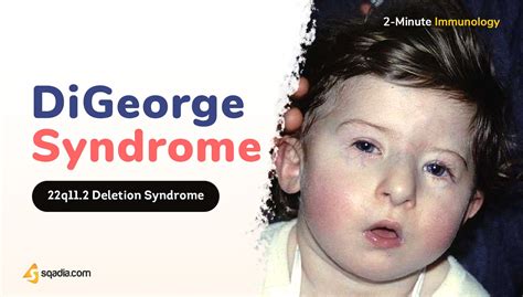 2-Minute Immunology: DiGeorge Syndrome