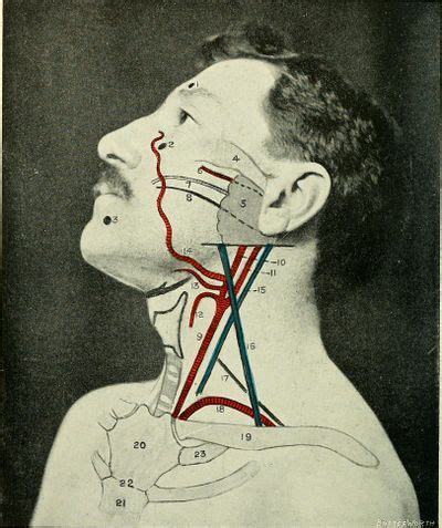 Common Carotid Artery - Physiopedia