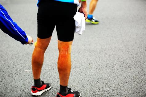 Injured Marathon Runner Legs Stock Image - Image of athletic, injury ...