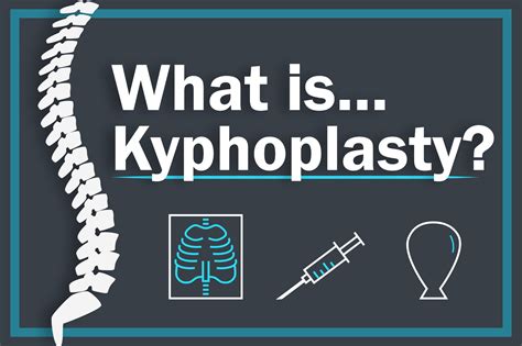 What Is Kyphoplasty? - UVA Radiology and Imaging