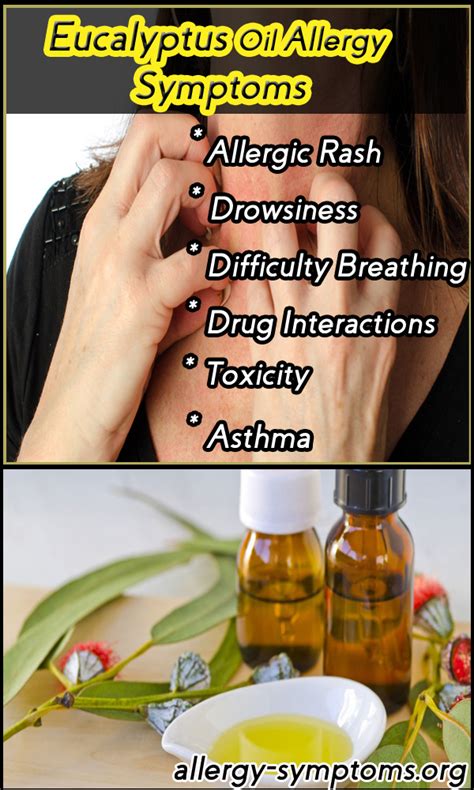 Eucalyptus Oil Allergy Symptoms and Diagnosis - Allergy-symptoms.org