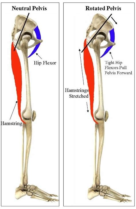 When Tight Does Not = Stretch: A closer look at hamstring “tightness ...