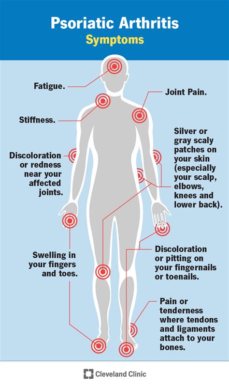 Psoriatic Arthritis: Symptoms and Treatments