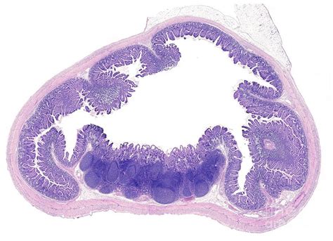 Peyer's Patch by Jose Calvo / Science Photo Library