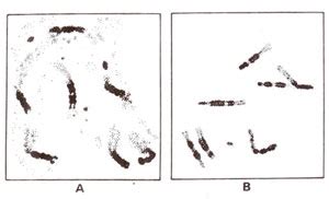 Euchromatin and heterochromatin | Physical Basis of Heredity The ...