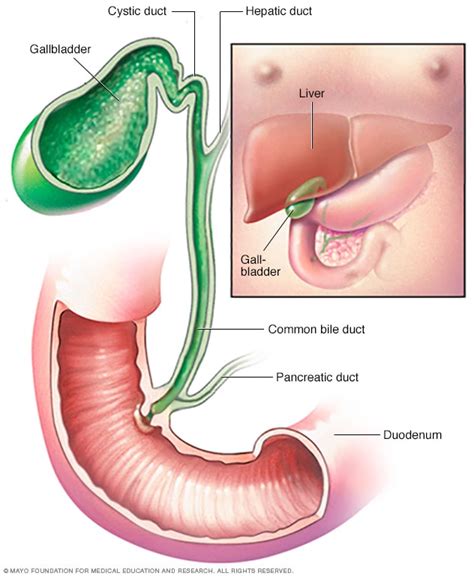 Cholangiocarcinoma (bile duct cancer) - Symptoms and causes - Mayo Clinic