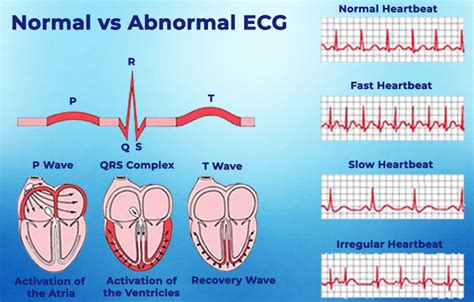 Echocardiogram (ECG) in Dubai | Best Cardiologist in Dubai | HMS Al Garhoud Hospital