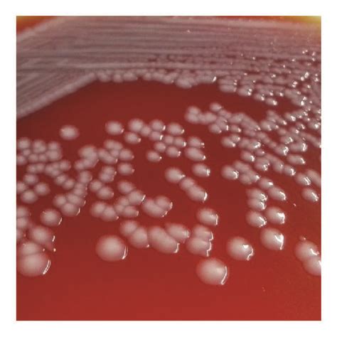 Colony morphology of parent Escherichia coli and antibiotic-induced... | Download Scientific Diagram