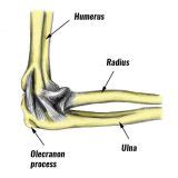 Olecranon Fracture - Symptoms, Causes & Treatment