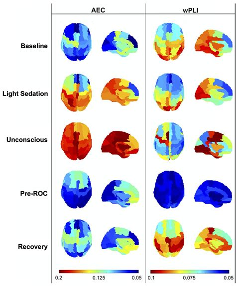 Neural Correlates of Consciousness | BIAPT