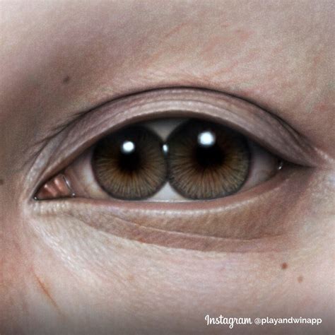 Pupula Duplex | Everything You Need To Know About The Rare Double Pupil Condition