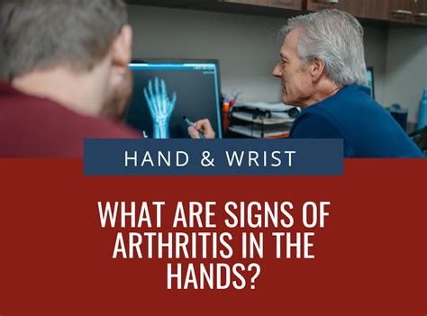 Our Fellowship Trained Hand Surgeons Give The Most Common Signs Of ...