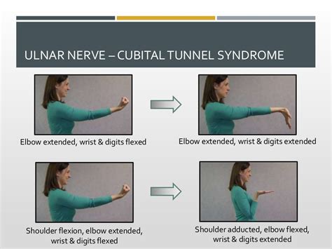 Nerve Gliding Exercises - Excursion and Valuable Indications for Ther…