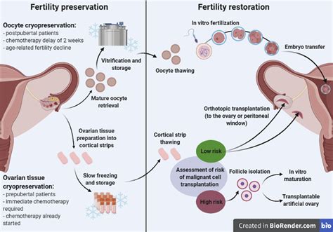 Transplantation of cryopreserved ovarian tissue in a series of 285 women: a review of five ...