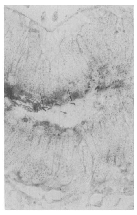 In situ hybridization with digoxigenin labeled H pylori specific probe ...