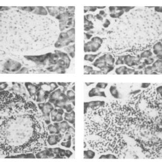 Islet cell autoantibodies (cytoplasmic). Indirect immunofluorescence... | Download Scientific ...