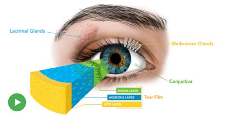 What is Dry Eye? - Nova Eyecare