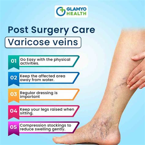 Varicose Veins Surgery Procedure, Risks and Complications