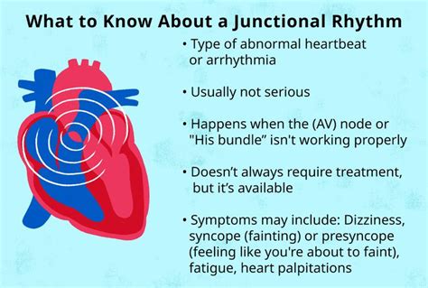 What Is a Junctional Rhythm?