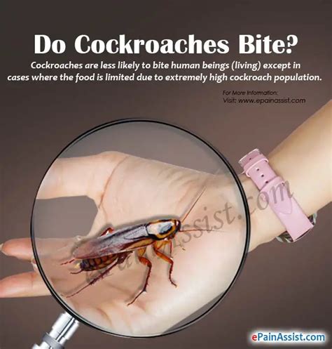 Pictures Of Roach Bites | Roach | cockroach | Insect