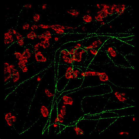 Applications > Super Resolution Microscopy