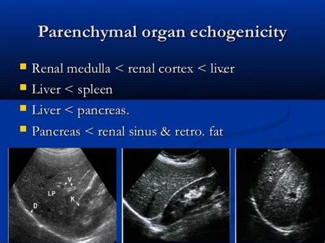 Liver ultrasound | Ultrasound sonography, Medical ultrasound, Diagnostic medical sonography