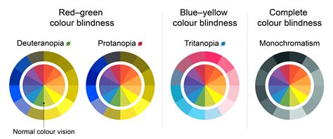 Color Blindness: Causes, types and Treatment – My Blog