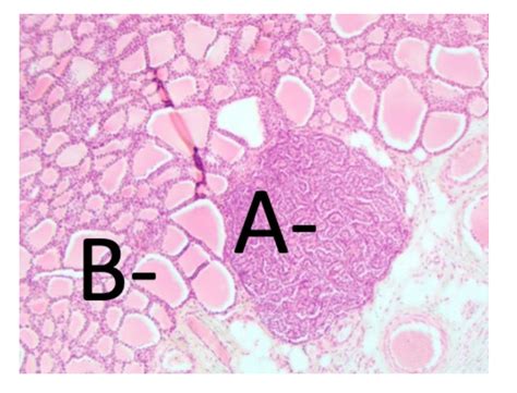 Solved B- A-−C A- B-capsule zona glomerulosa zona | Chegg.com