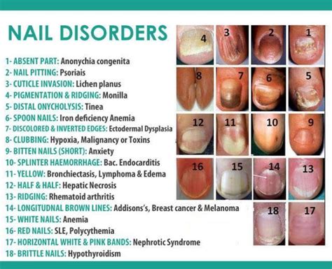 Pin by Barbara Mullins on Health and Beauty (With images) | Nail ...