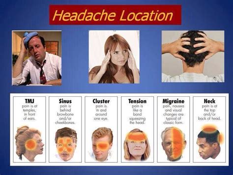 Headache Locations | Headache location, Headache, Headache chart