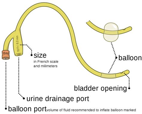 Urinary Catheter Types