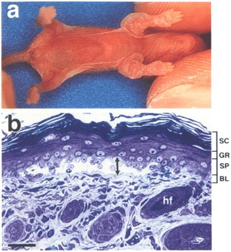 Mice homozygous for the targeted K14 allele exhibit gross blistering ...