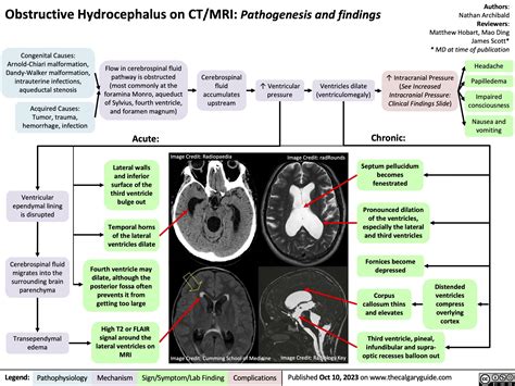 Obstructive Hydrocephalus on CT MRI Pathogenesis and findings | Calgary Guide