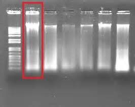 How do interpret my DNA gel electrophoresis results?