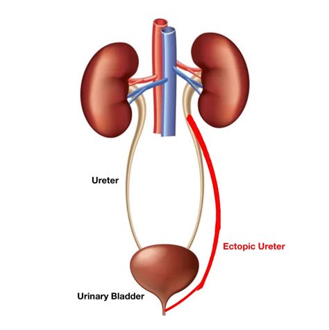 What Is An Ectopic Ureter In Dogs? | Kingsdale Animal Hospital