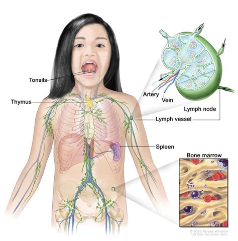 Hodgkin Lymphoma | Vanderbilt-Ingram Cancer Center