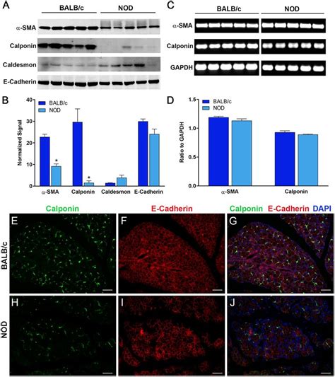 Decrease in smooth muscle associated proteins in NOD mice. Total... | Download Scientific Diagram