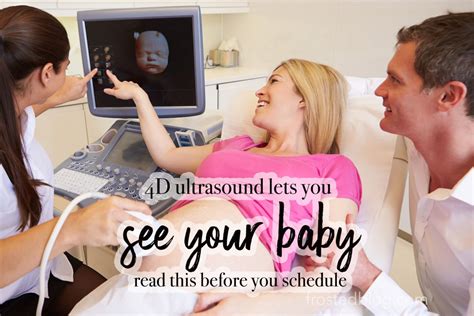 4D Ultrasound Near Me - What to Know Before You Schedule