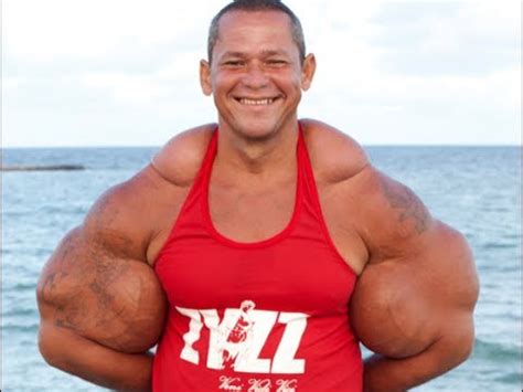 How Not to Lift: Top 10 Synthol Superstars