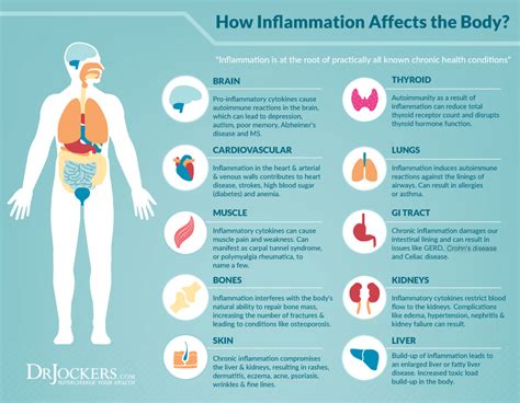 Inflammation – 7 Signs You Shouldn’t Ignore