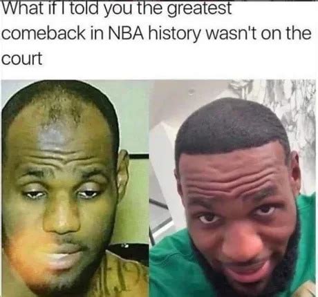 The best Hairline memes :) Memedroid