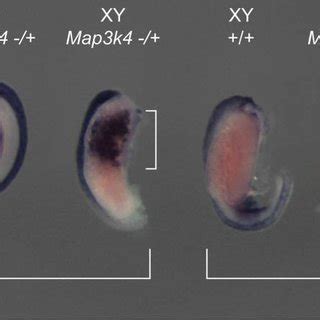 Ovotestis development in embryos haploinsufficient for Map3k4 ...