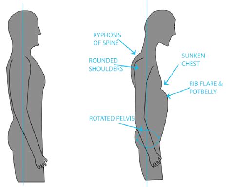 Concave Chest