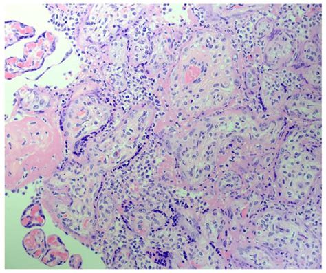 Pathogens MDPI on Twitter: "Molecular Pathology Analysis of #SARSCoV2 in Syncytiotrophoblast and ...