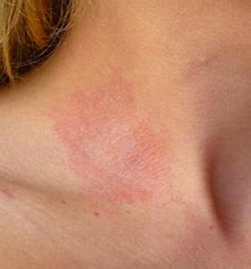 10 of the Most Common Skin Conditions: Photos and Treatments