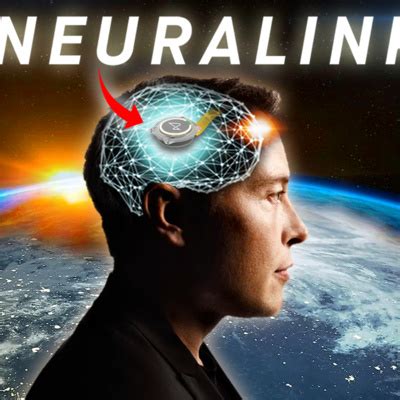 2023: Elon Musk's Neuralink Begins Chip Implants in HUMANS by Neuralink ...